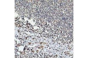 Immunohistochemical analysis of Beta-tubulin staining in human tonsil formalin fixed paraffin embedded tissue section. (TUBB anticorps)