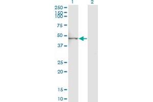 Western Blot analysis of PLA2G15 expression in transfected 293T cell line by LYPLA3 monoclonal antibody (M01), clone 3B11.