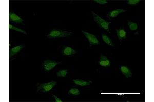 Immunofluorescence of purified MaxPab antibody to CRY1 on HeLa cell.