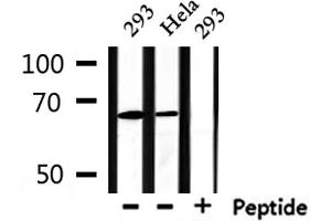 Western blot analysis of extracts from 293 and Hela, using PIAS2 Antibody.