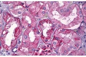 anti-K-Cadherin (CDH6) (Extracellular Domain) antibody