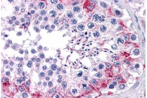 Human Testis: Formalin-Fixed, Paraffin-Embedded (FFPE) (CCDC98 anticorps  (AA 1-313))