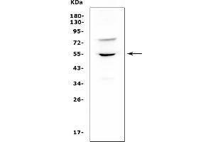 Western blot analysis of UGT1A6 using anti-UGT1A6 antibody (ABIN7601003).