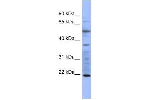 WB Suggested Anti-MYL3  Antibody Titration: 0.