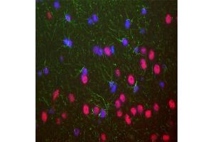 ABIN1580460 was used to stain a section of formalin fixed adult rat brain, specifically the hippocampus.