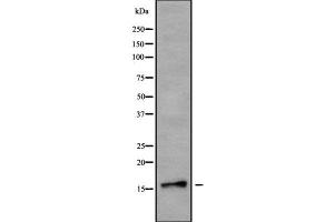 Western blot analysis NDUFB7 using HuvEc whole cell lysates (NDUFB7 anticorps  (Internal Region))
