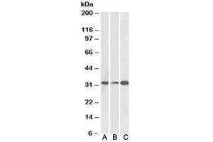 Western blot testing of human [A], mouse [B] and rat [C] brain lysate with EB3 antibody at 0. (MAPRE3 anticorps)