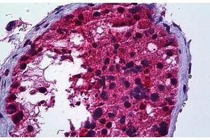 Human Testis: Formalin-Fixed, Paraffin-Embedded (FFPE) (PMS2 anticorps  (AA 125-174))