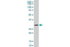 SIX3 monoclonal antibody (M08), clone 2B9. (SIX3 anticorps  (AA 273-332))