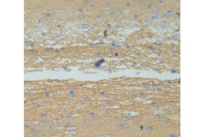 IHC-P analysis of Rat Tissue, with DAB staining. (IL12B anticorps  (AA 30-311))