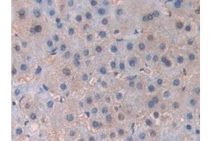 Detection of PIK3Cb in Human Liver Tissue using Polyclonal Antibody to Phosphoinositide-3-Kinase Catalytic Beta Polypeptide (PIK3Cb)