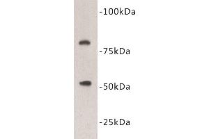 Western Blotting (WB) image for anti-Vitamin K-dependent protein C (PROC) antibody (ABIN1855001) (PROC anticorps)