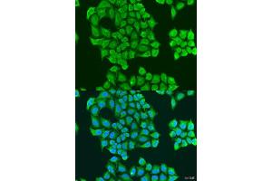 Immunofluorescence analysis of U2OS cells using SYT11 antibody.
