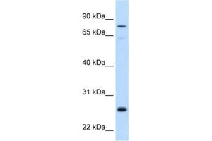 Western Blotting (WB) image for anti-Glutathione S-Transferase mu 2 (Muscle) (GSTM2) antibody (ABIN2462480) (GSTM2 anticorps)