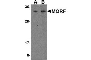 Western blot analysis of MORF4 in K562 cell lysate with MORF4 antibody at (A) 1 and (B) 2 μg/ml. (MORF4 anticorps  (N-Term))