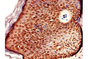 Immunohistochemistry of paraffin-embedded human skin tissue using ABIN7151618 at dilution of 1:100 (ERVK-6 anticorps  (AA 90-632))