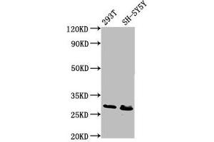 Western Blot Positive WB detected in: 293T whole cell lysate, SH-SY5Y whole cell lysate All lanes: RFXANK antibody at 6. (RFXANK anticorps  (AA 3-84))