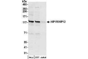 Western Blotting (WB) image for anti-Huntingtin Interacting Protein 1 Related (HIP1R) (AA 1018-1068) antibody (ABIN7449749)