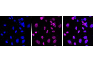 Immunocytochemical staining of Hela cells with CDCA51 antibody (ABIN7798019), 1:1,000). (Recombinant CDCA5 anticorps)