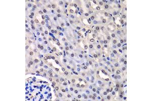 Immunohistochemistry of paraffin-embedded mouse kidney using HNRNPM antibody (ABIN5975447) at dilution of 1/100 (40x lens). (HNRNPM anticorps)