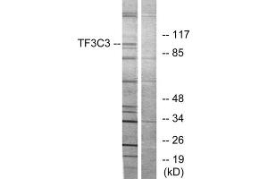 Western blot analysis of extracts from 293 cells, using TF3C3 antibody. (GTF3C3 anticorps  (N-Term))