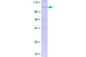 Image no. 1 for Tripartite Motif Containing 71, E3 Ubiquitin Protein Ligase (TRIM71) (AA 1-868) protein (GST tag) (ABIN1323749)