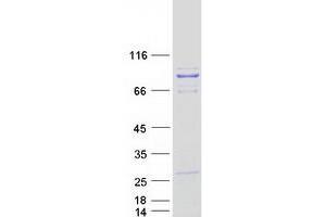 Validation with Western Blot