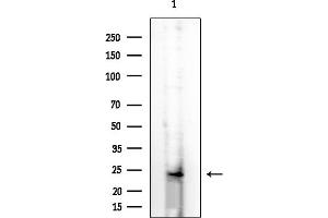 Western blot analysis of lysates from HUVEC cells, using OR6P1 Antibody at 1/1000 dilution.