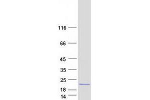 Validation with Western Blot
