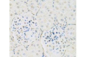 Immunohistochemistry of paraffin-embedded Rat kidney using KAT2A Polyclonal Antibody at dilution of 1:100 (40x lens). (KAT2A anticorps)