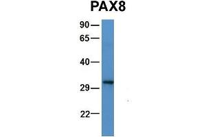 Host:  Rabbit  Target Name:  PAX8  Sample Type:  Human 721_B  Antibody Dilution:  1. (PAX5 anticorps  (N-Term))