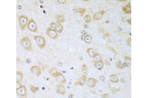 Immunohistochemistry of paraffin-embedded Mouse brain using ACOX1 Polyclonal Antibody at dilution of 1:100 (40x lens). (ACOX1 anticorps)