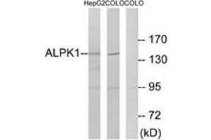 Western blot analysis of extracts from COLO/HepG2 cells, using ALPK1 Antibody. (ALPK1 anticorps  (AA 11-60))