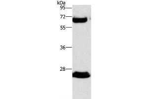 Western Blot analysis of Human fetal liver tissue using GGT1 Polyclonal Antibody at dilution of 1:300 (GGT1 anticorps)