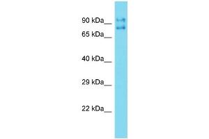 Western Blotting (WB) image for anti-Tigger Transposable Element Derived 5 (TIGD5) (N-Term) antibody (ABIN2774522) (TIGD5 anticorps  (N-Term))