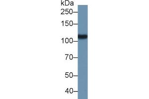 Detection of PMSA in Porcine Kidney lysate using Polyclonal Antibody to Prostate-specific Membrane Antigen (PMSA)