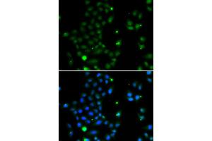 Immunofluorescence analysis of MCF7 cell using GCM1 antibody. (GCM1 anticorps)