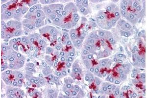 Pancreas, Human: Formalin-Fixed, Paraffin-Embedded (FFPE) (MUC1 anticorps)