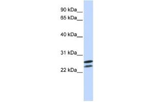 WB Suggested Anti-HOXB4 Antibody   Titration: 1 ug/ml   Positive Control: Jurkat Whole Cell (HOXB4 anticorps  (N-Term))