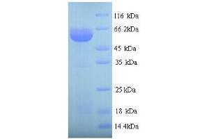 SDS-PAGE (SDS) image for Prolyl 4-Hydroxylase, beta Polypeptide (P4HB) (AA 18-508) protein (His tag) (ABIN5713710)