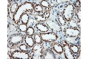Immunohistochemical staining of paraffin-embedded liver tissue using anti-NME4 mouse monoclonal antibody. (NME4 anticorps)
