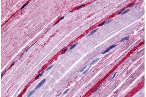 Myocytes, Human: Formalin-Fixed Paraffin-Embedded (FFPE)