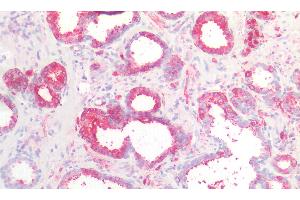 Detection of CTNNbIP1 in Human Prostate Tissue using Polyclonal Antibody to Catenin Beta Interacting Protein 1 (CTNNbIP1)