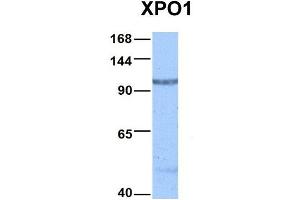 Host:  Rabbit  Target Name:  XPO1  Sample Type:  Hela  Antibody Dilution:  1. (XPO1 anticorps  (C-Term))