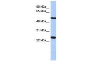 Image no. 1 for anti-Transmembrane Protein 161B (TMEM161B) (AA 71-120) antibody (ABIN6741235) (TMEM161B anticorps  (AA 71-120))