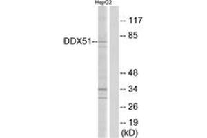 Western blot analysis of extracts from HepG2 cells, using DDX51 Antibody.