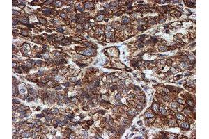 Image no. 2 for anti-Sec1 Family Domain Containing 1 (SCFD1) antibody (ABIN1500818) (SCFD1 anticorps)