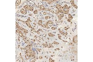 IHC analysis of U1A/SNRPA using anti-U1A/SNRPA antibody (ABIN7600891). (SNRPA1 anticorps  (AA 25-218))