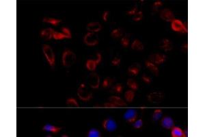 Immunofluorescence analysis of HeLa cells using COPB2 Polyclonal Antibody at dilution of 1:100 (40x lens).