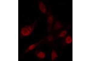 ABIN6272432 staining Hela by IF/ICC. (Sp3/4 anticorps)